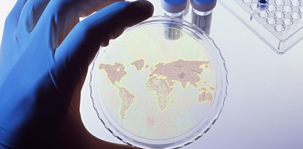 影响微生物检验结果因素分析与质量控制策略